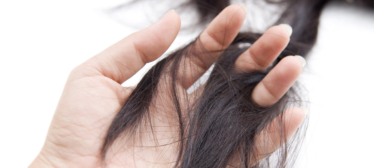 Stress et perte de cheveux